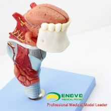 THROAT02 (12506) Larynx-Modell mit Toungue und Zähnen, Full Size Vergrößern, 5 Teile, HNO-Modelle&gt; Larynx-Modelle
